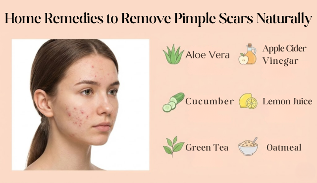 how to remove pimple scars naturally
