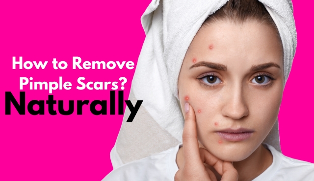 how to remove pimple scars naturally